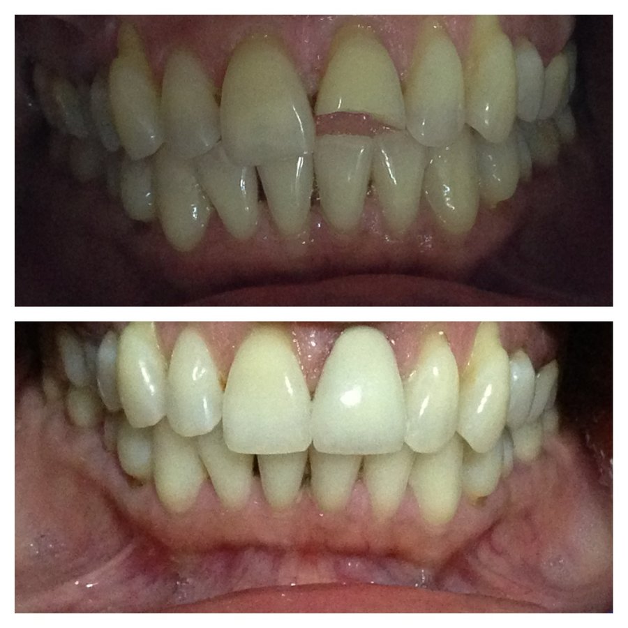 MAHATMA Multispeciality Dental Hospital and IMPLANT Centre - MAHATMA Multispeciality Dental Hospital and IMPLANT Centre