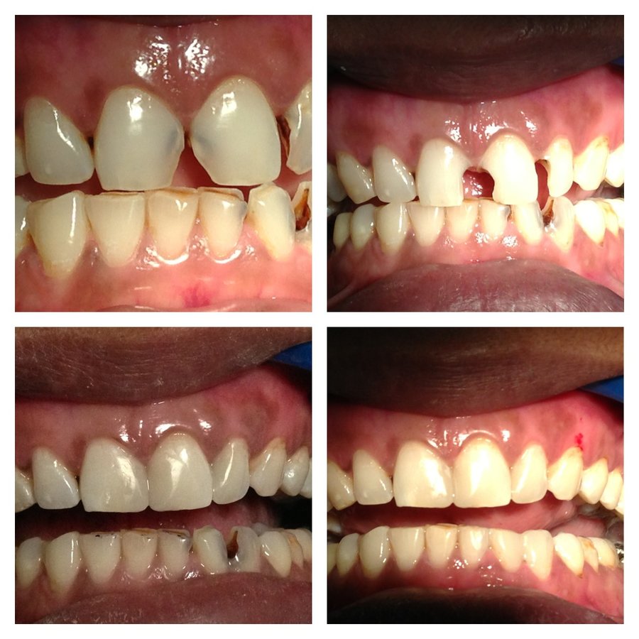 MAHATMA Multispeciality Dental Hospital and IMPLANT Centre - MAHATMA Multispeciality Dental Hospital and IMPLANT Centre