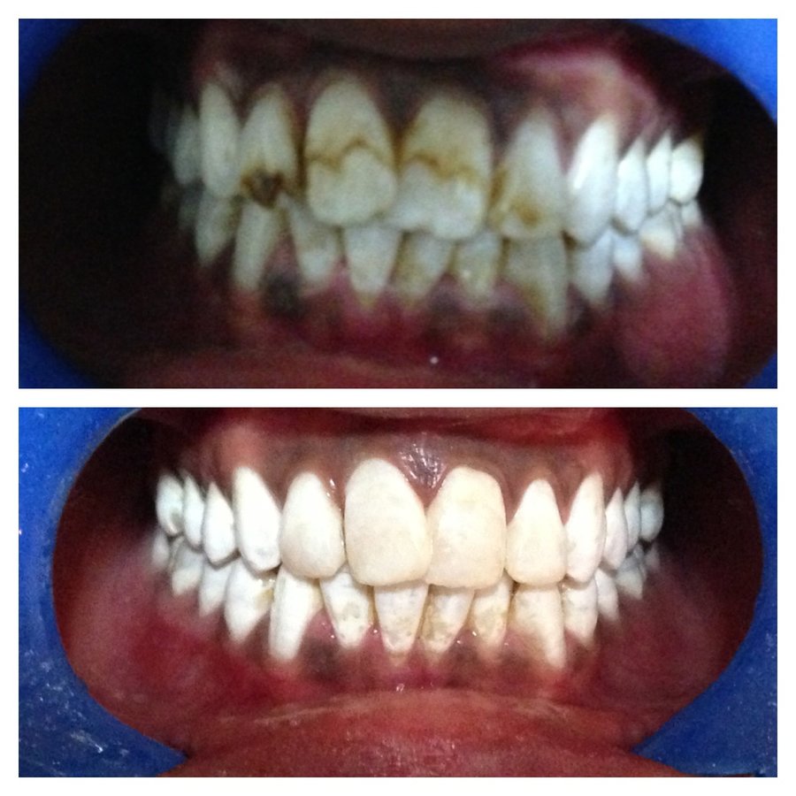 MAHATMA Multispeciality Dental Hospital and IMPLANT Centre - MAHATMA Multispeciality Dental Hospital and IMPLANT Centre