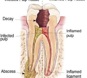 جعل أسناني - Make My Tooth
