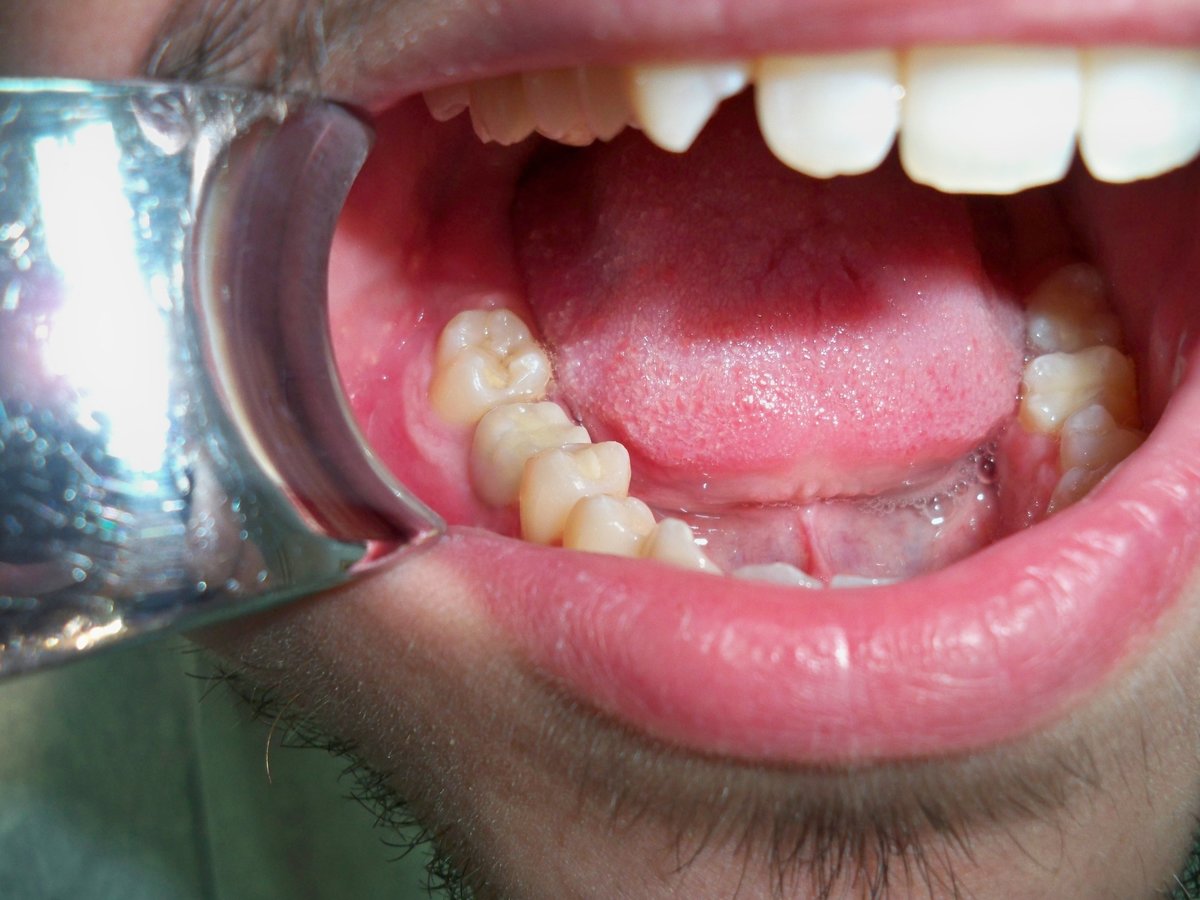 Maksident Vrshkovski - Dental Studio - Maksident Vrshkovski - Dental Studio