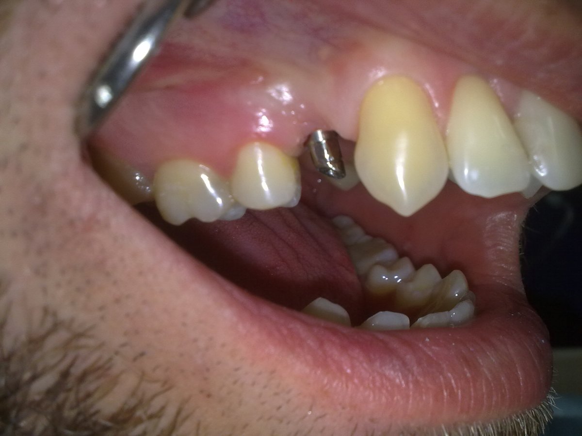Maksident Vrshkovski - Dental Studio - Maksident Vrshkovski - Dental Studio