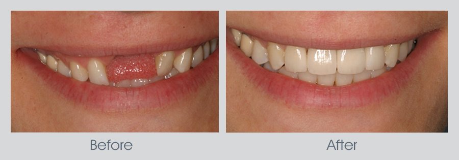 Malar Dental Clinic - Malar Dental Clinic