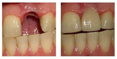 Malar Dental Clinic - Malar Dental Clinic