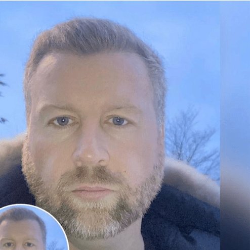 Manchester Hair Transplant Clinic - Manchester Hair Transplant Clinic