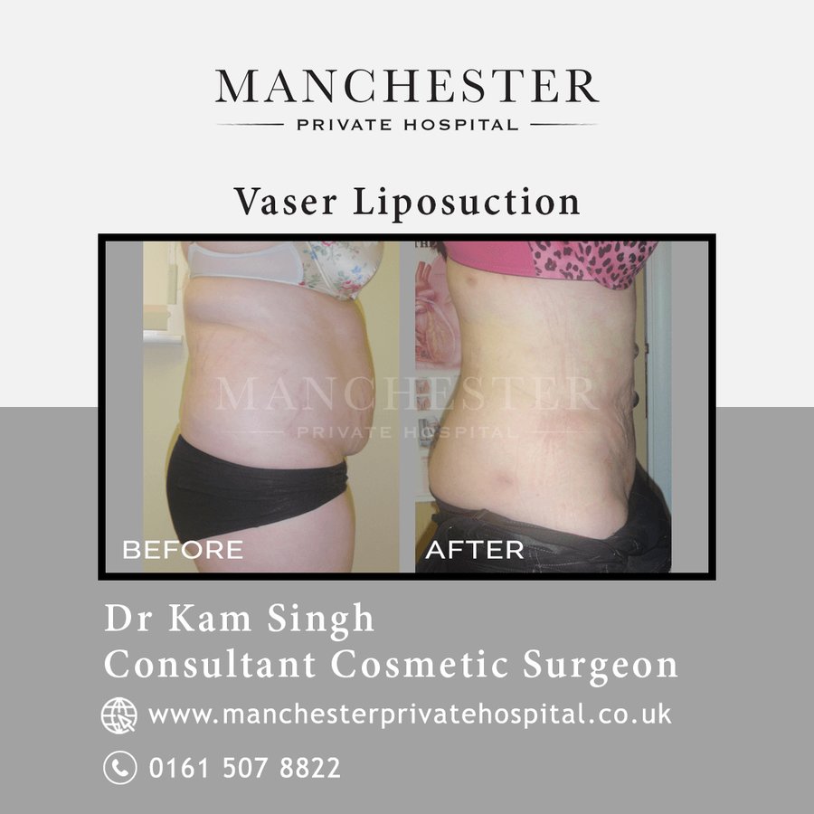 Manchester Private Hospital - Birmingham - Manchester Private Hospital - Birmingham