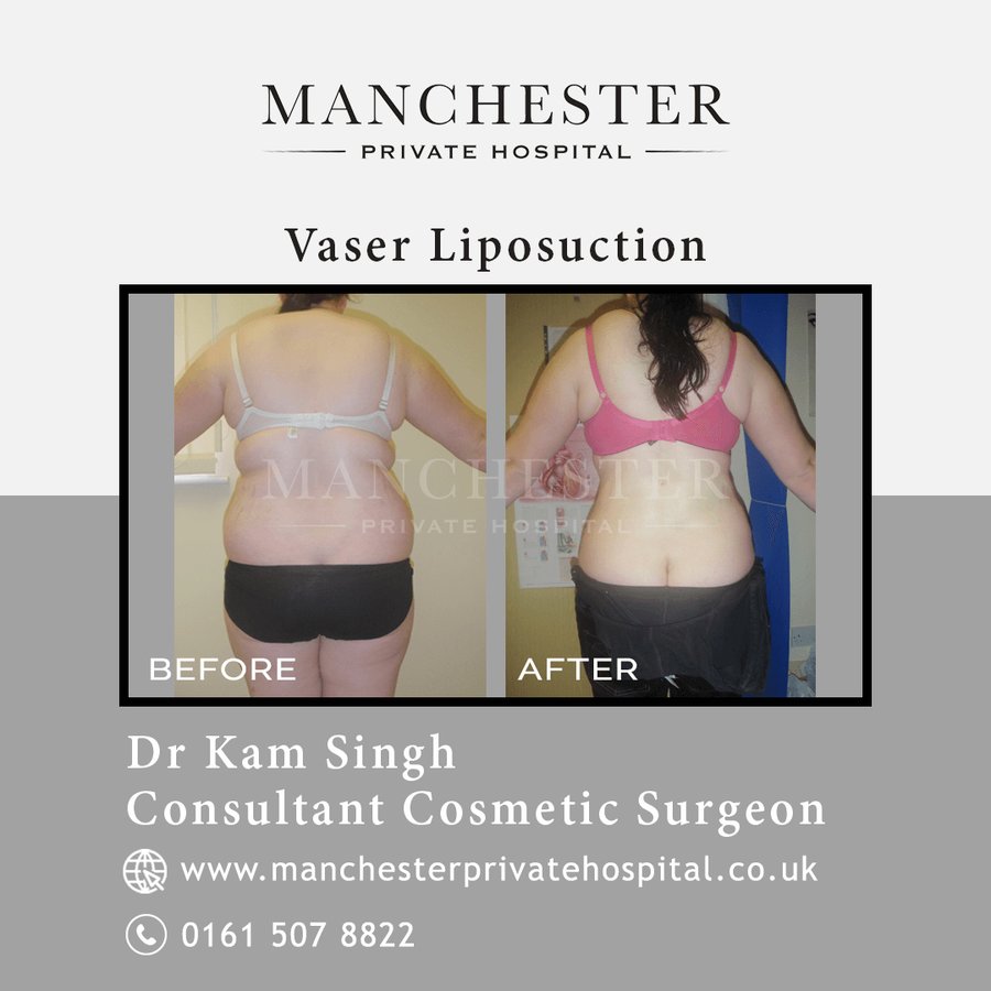 Manchester Private Hospital - Birmingham - Manchester Private Hospital - Birmingham