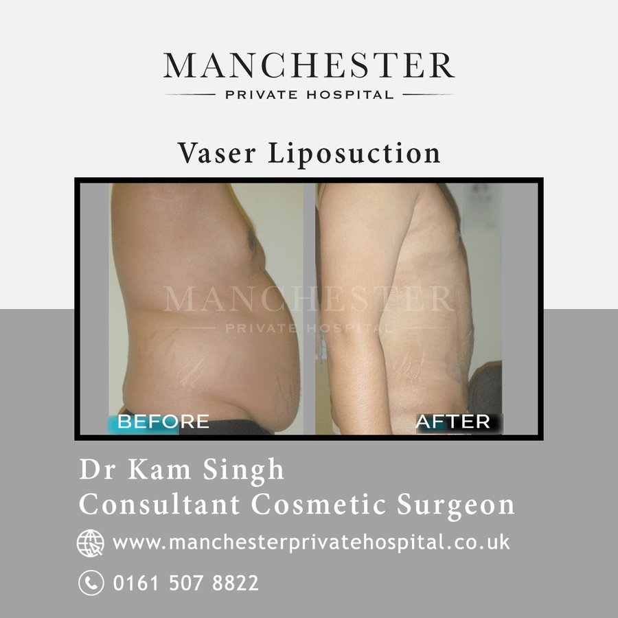 Manchester Private Hospital - Birmingham - Manchester Private Hospital - Birmingham