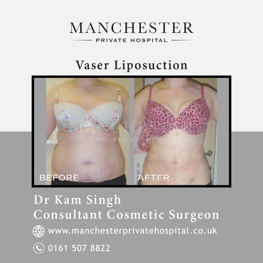 Manchester Private Hospital - Birmingham - Manchester Private Hospital - Birmingham