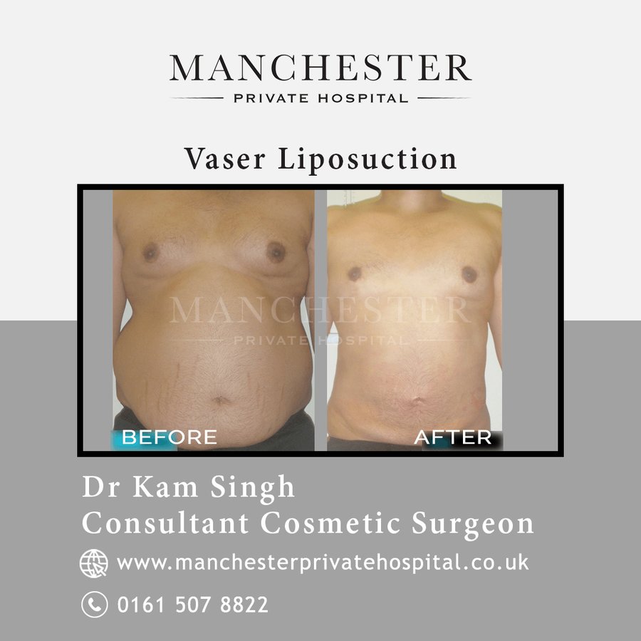 Manchester Private Hospital - Birmingham - Manchester Private Hospital - Birmingham