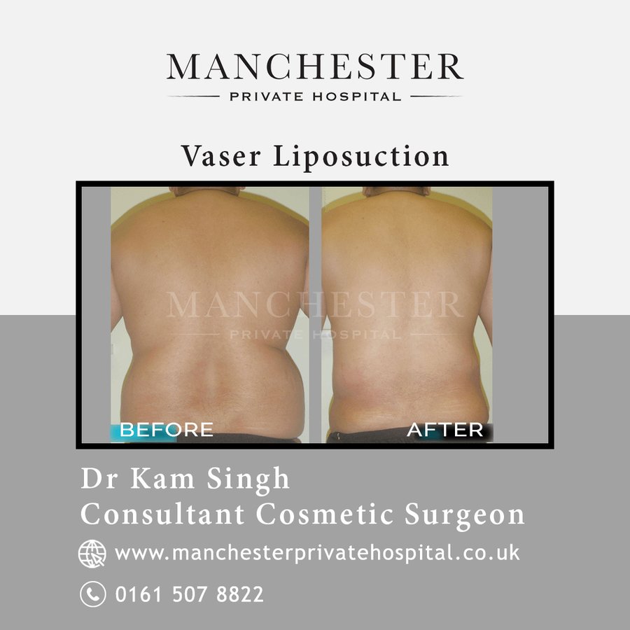 Manchester Private Hospital - Birmingham - Manchester Private Hospital - Birmingham