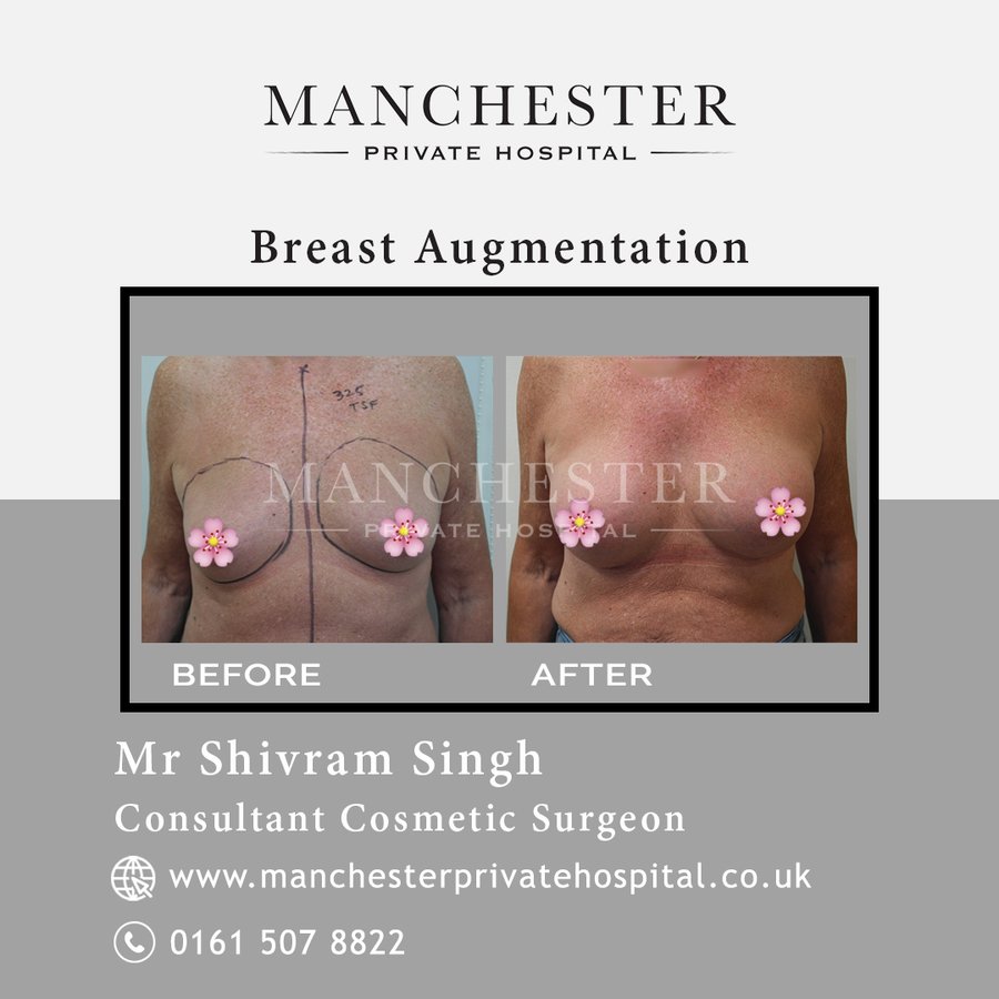 Manchester Private Hospital - Birmingham - Manchester Private Hospital - Birmingham