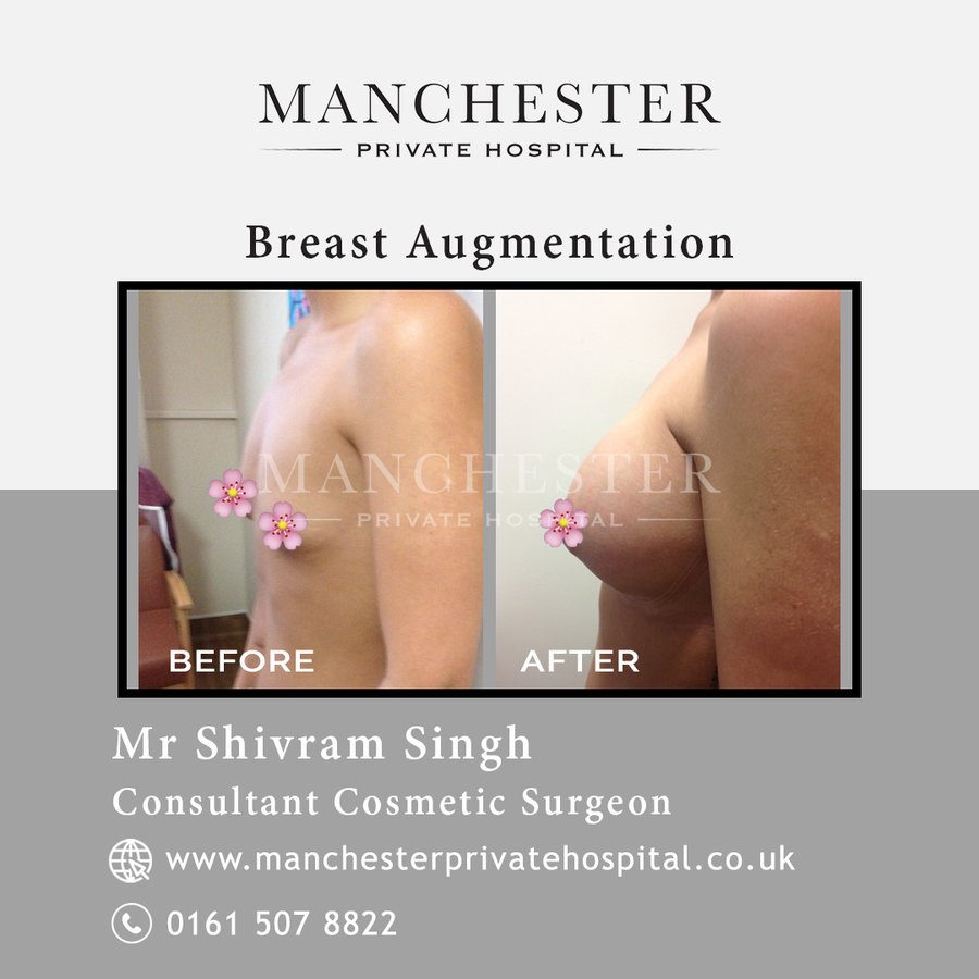 Manchester Private Hospital - Birmingham - Manchester Private Hospital - Birmingham