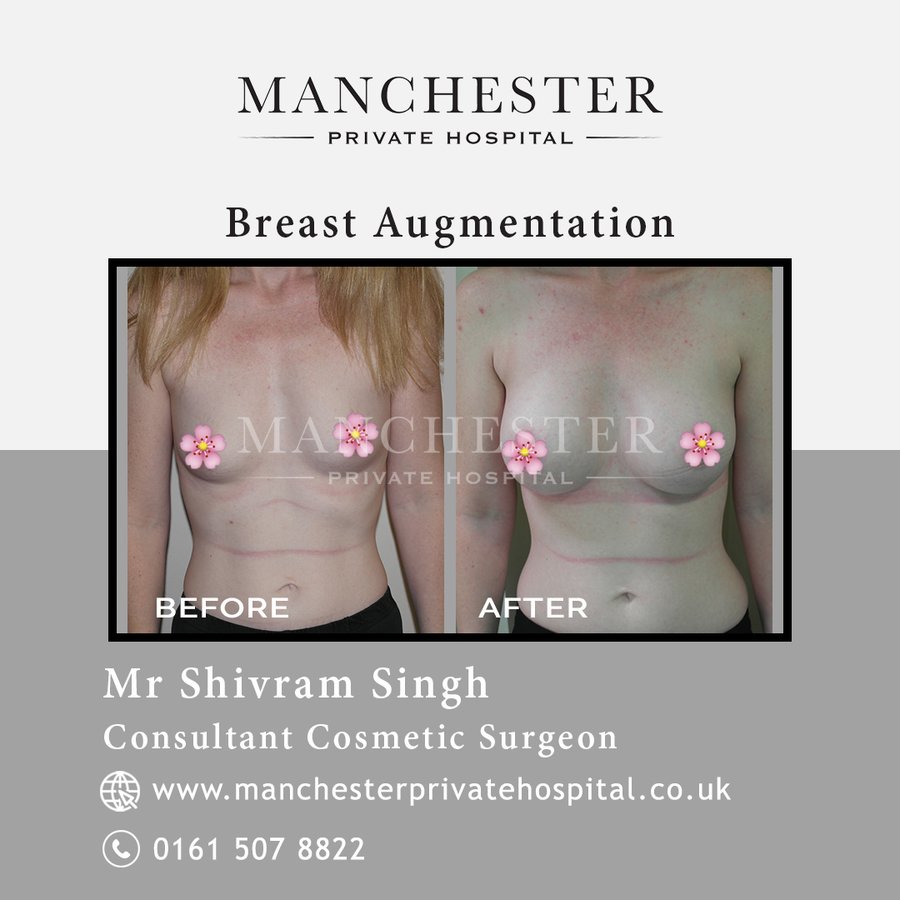 Manchester Private Hospital - Birmingham - Manchester Private Hospital - Birmingham