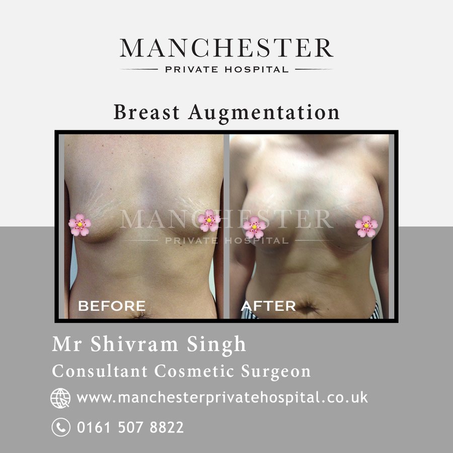 Manchester Private Hospital - Birmingham - Manchester Private Hospital - Birmingham