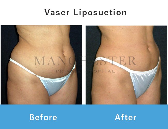 Manchester Private Hospital - Birmingham - Manchester Private Hospital - Birmingham