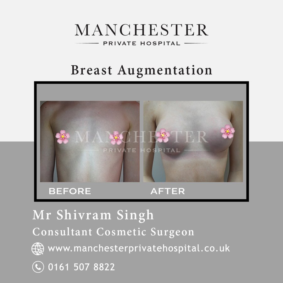 Manchester Private Hospital - Birmingham - Manchester Private Hospital - Birmingham