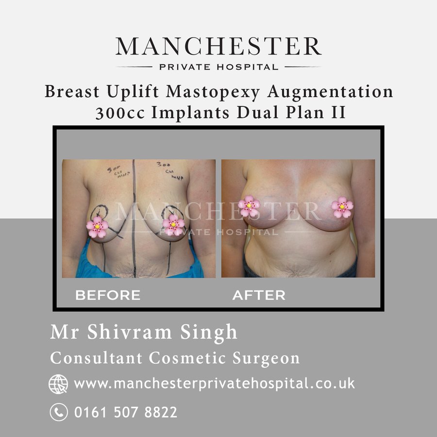 Manchester Private Hospital - Birmingham - Manchester Private Hospital - Birmingham