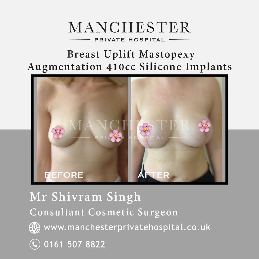 Manchester Private Hospital - Birmingham - Manchester Private Hospital - Birmingham