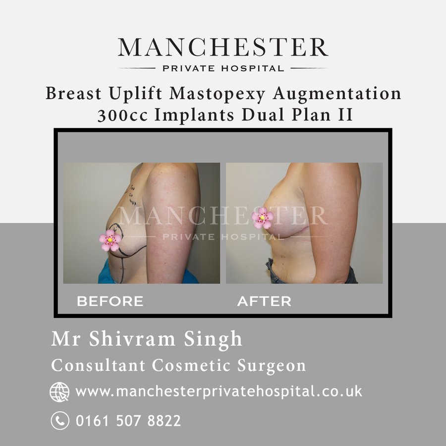 Manchester Private Hospital - Birmingham - Manchester Private Hospital - Birmingham