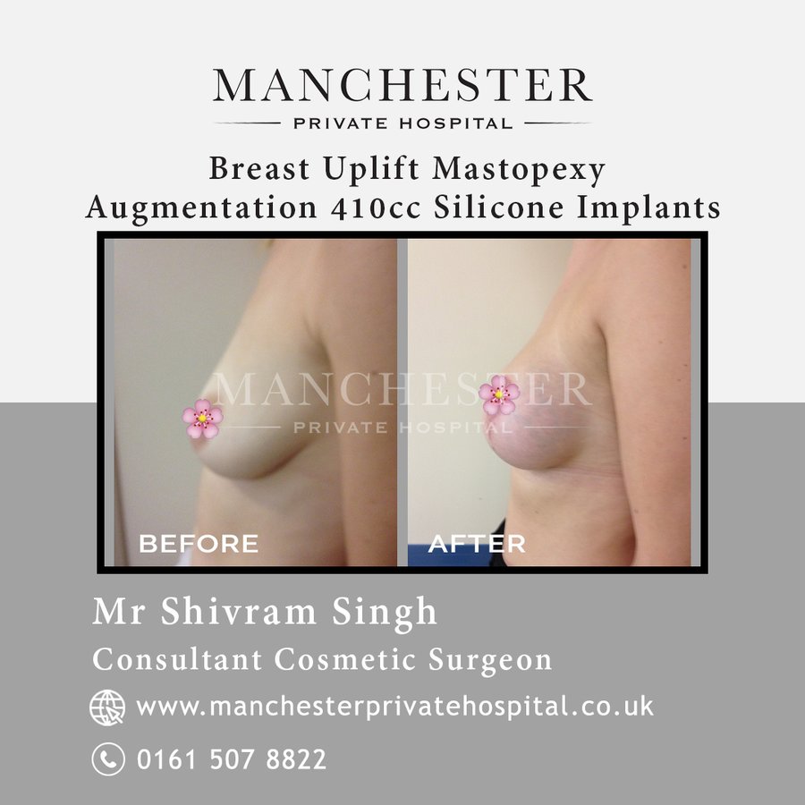 Manchester Private Hospital - Birmingham - Manchester Private Hospital - Birmingham