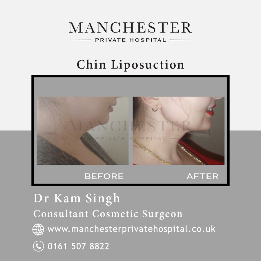 Manchester Private Hospital - Birmingham - Manchester Private Hospital - Birmingham