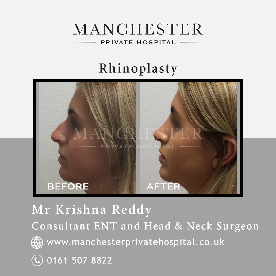 Manchester Private Hospital - Birmingham - Manchester Private Hospital - Birmingham