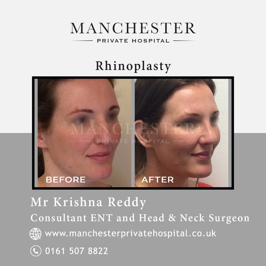 Manchester Private Hospital - Birmingham - Manchester Private Hospital - Birmingham