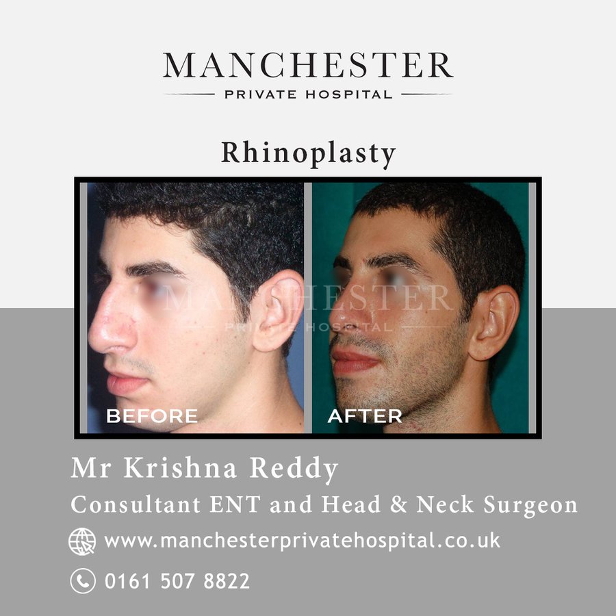 Manchester Private Hospital - Birmingham - Manchester Private Hospital - Birmingham