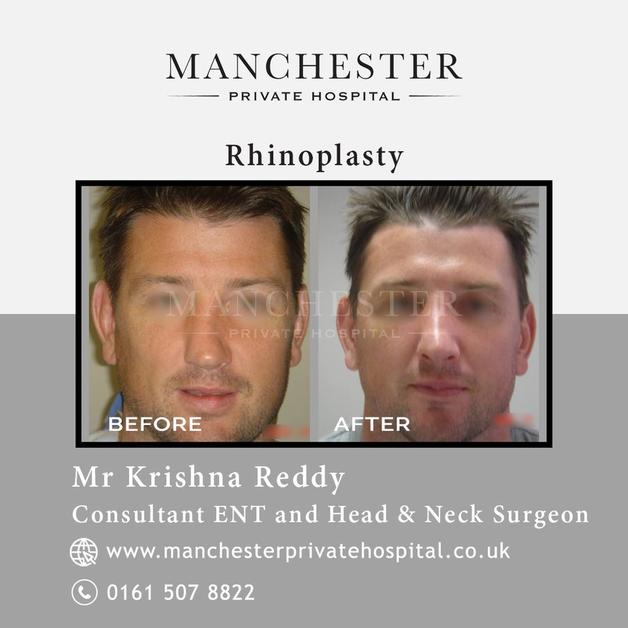 Manchester Private Hospital - Birmingham - Manchester Private Hospital - Birmingham