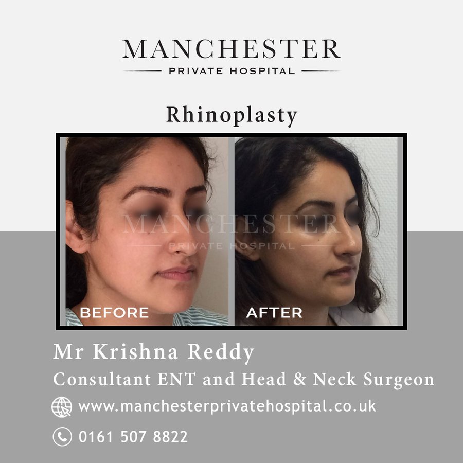 Manchester Private Hospital - Birmingham - Manchester Private Hospital - Birmingham