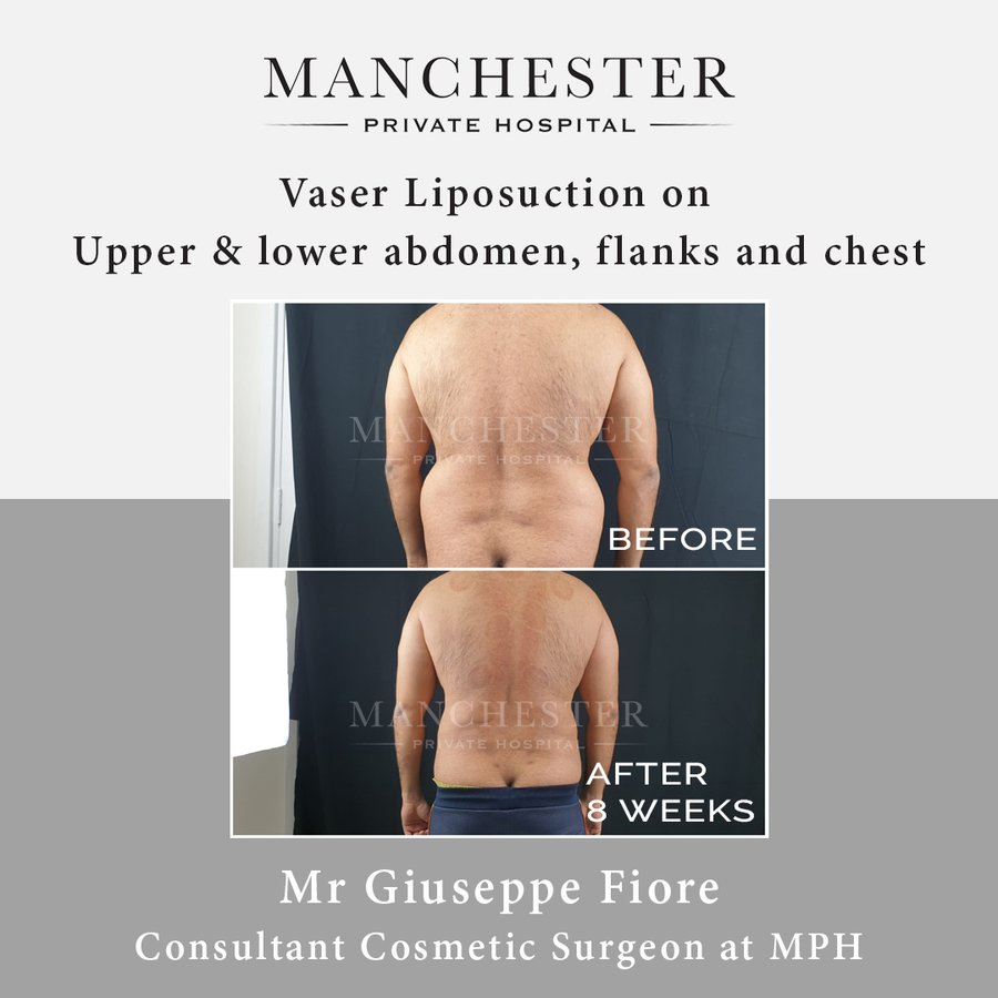 Manchester Private Hospital - Birmingham - Manchester Private Hospital - Birmingham