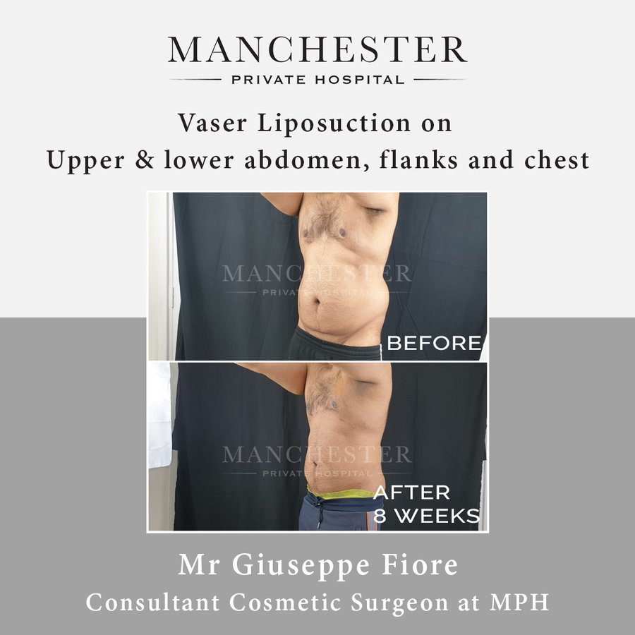 Manchester Private Hospital - Birmingham - Manchester Private Hospital - Birmingham