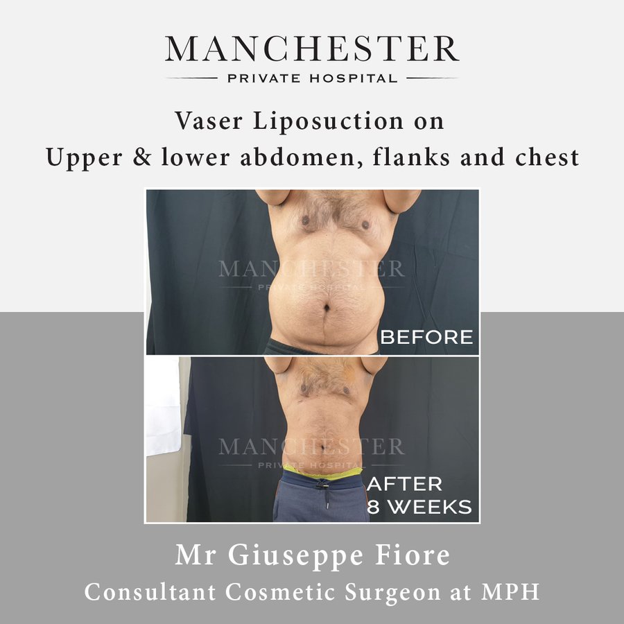 Manchester Private Hospital - Birmingham - Manchester Private Hospital - Birmingham