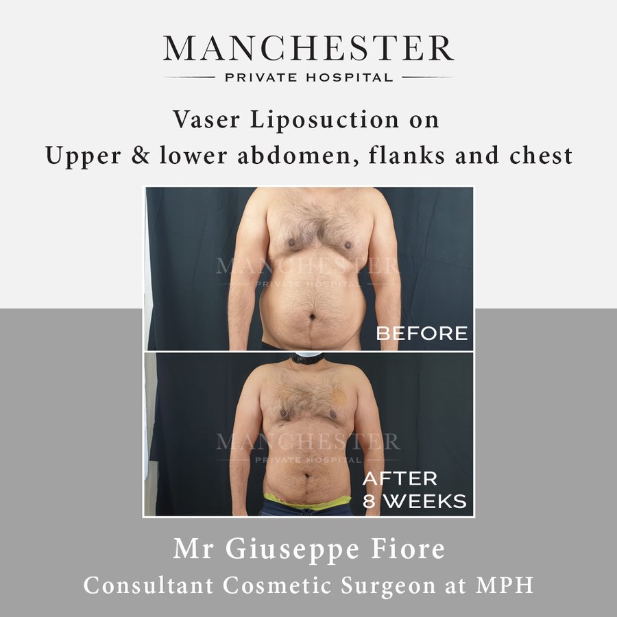 Manchester Private Hospital - Birmingham - Manchester Private Hospital - Birmingham