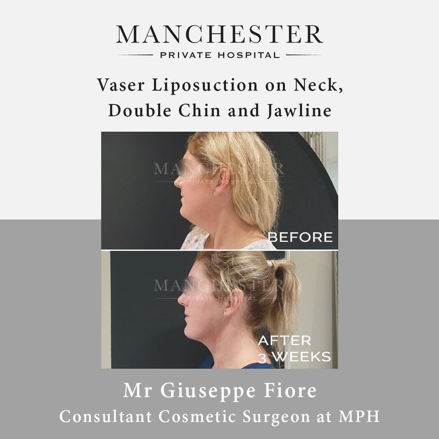 Manchester Private Hospital - Birmingham - Manchester Private Hospital - Birmingham