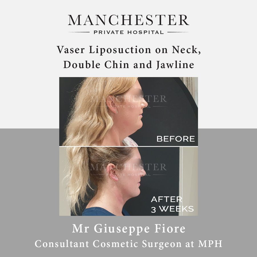 Manchester Private Hospital - Birmingham - Manchester Private Hospital - Birmingham