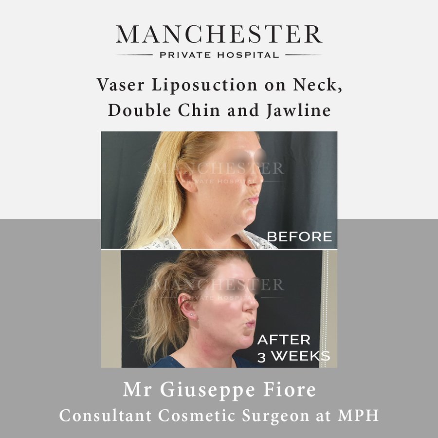 Manchester Private Hospital - Birmingham - Manchester Private Hospital - Birmingham