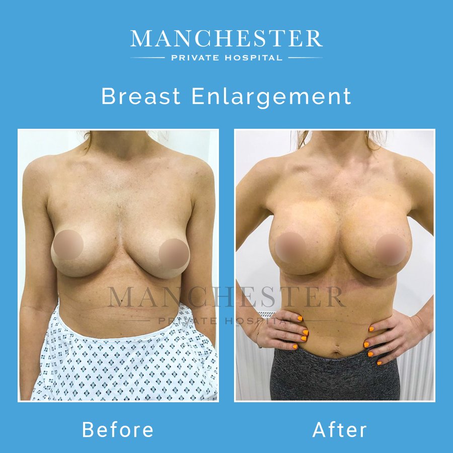 Manchester Private Hospital - Birmingham - Manchester Private Hospital - Birmingham