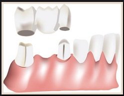 MarchWood Dental - MarchWood Dental