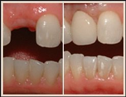 MarchWood Dental - MarchWood Dental