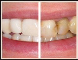 MarchWood Dental - MarchWood Dental