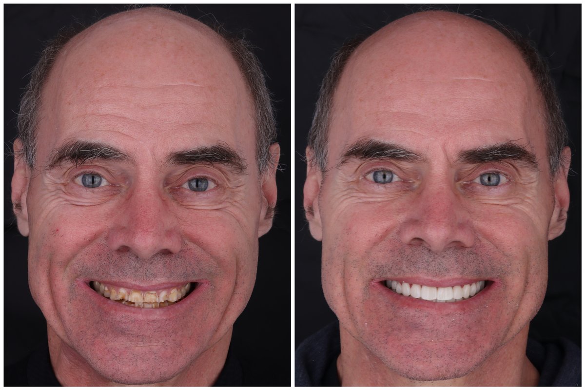 Marietta Dental Care - Tijuana - Marietta Dental Care - Tijuana