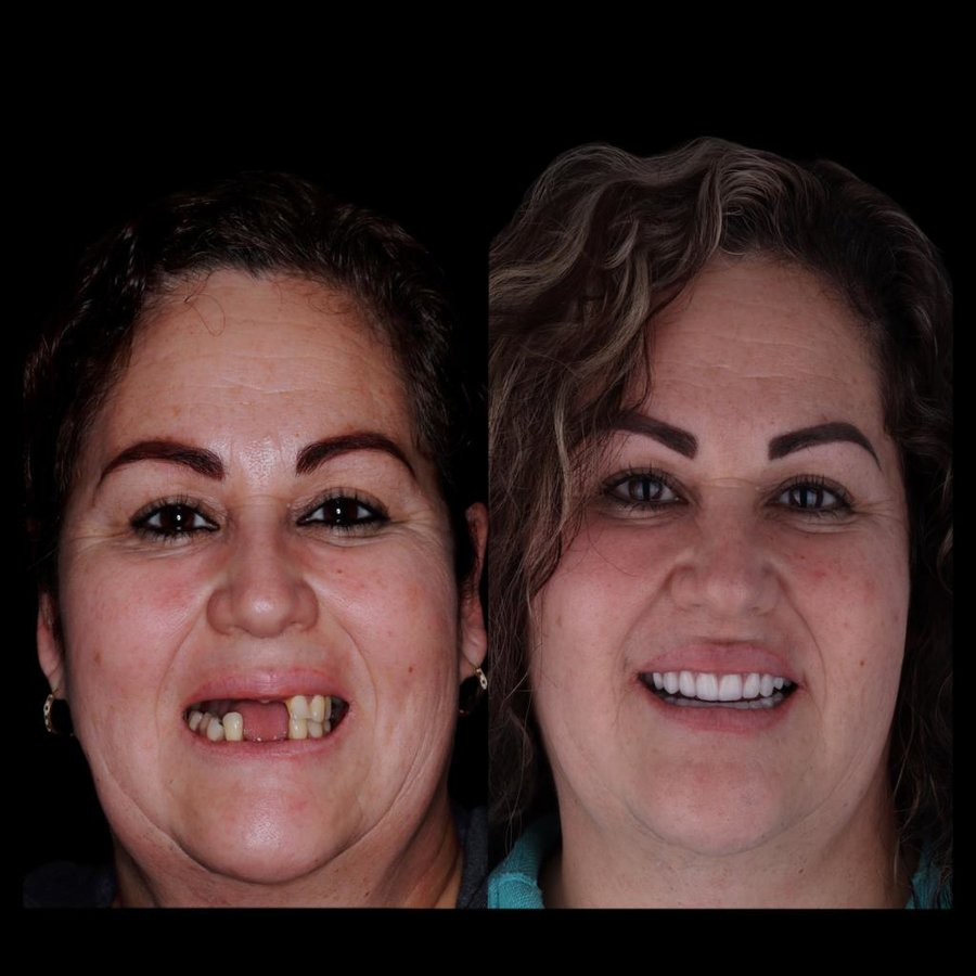 Marietta Dental Care - Marietta Dental Care