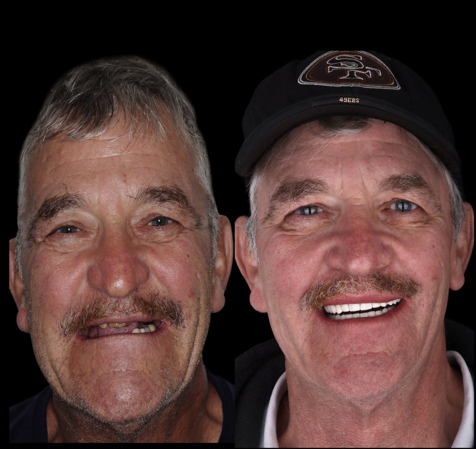 Marietta Dental Care - Marietta Dental Care