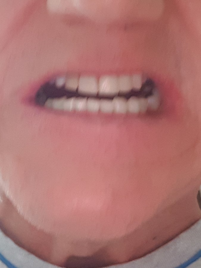 مركز مرمريسميل لطب الأسنان - MarmariSmile Dental Center