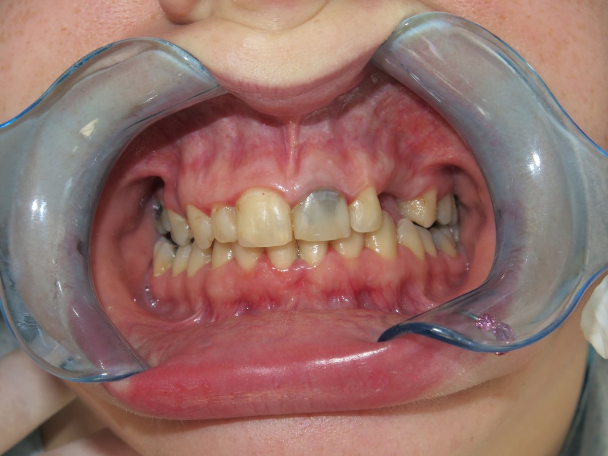 مركز مرمريسميل لطب الأسنان - MarmariSmile Dental Center