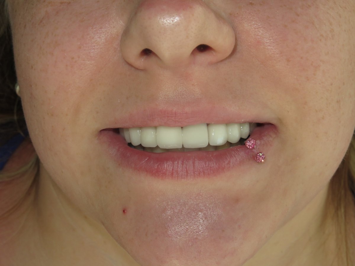 مركز مرمريسميل لطب الأسنان - MarmariSmile Dental Center