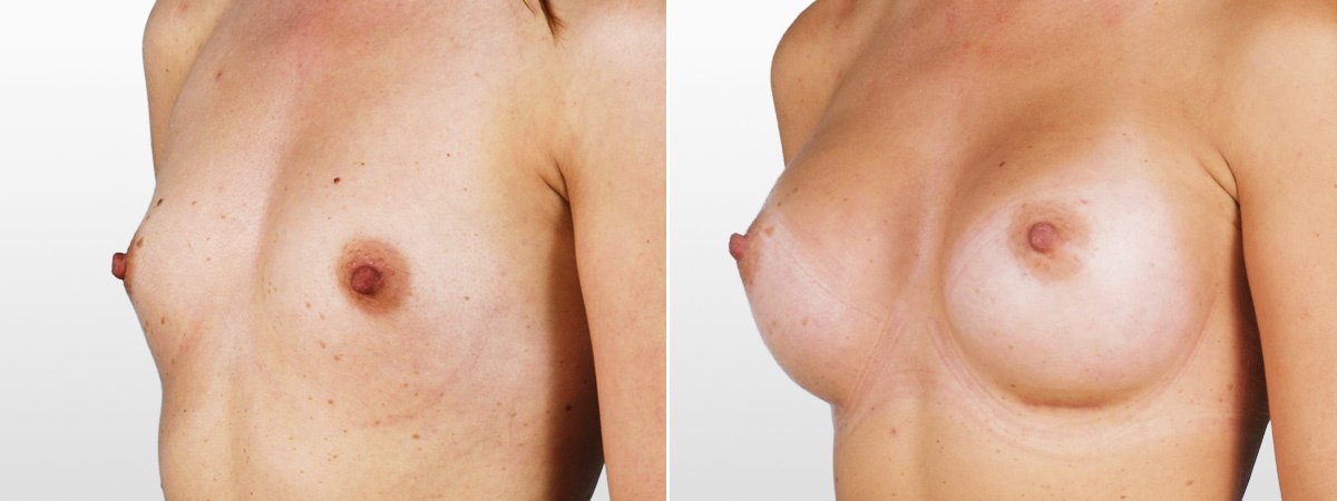 Martin Paciorek - Martin Paciorek