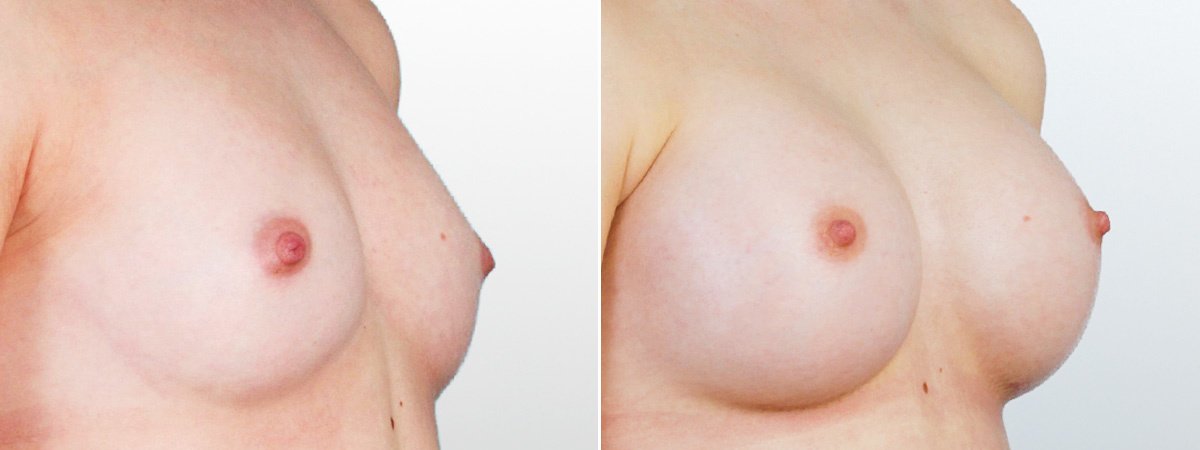 Martin Paciorek - Martin Paciorek